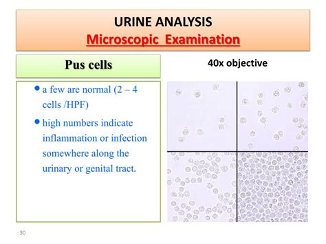 pus cells normal value|What Normal (and Abnormal) Urine Test Results Reveal .